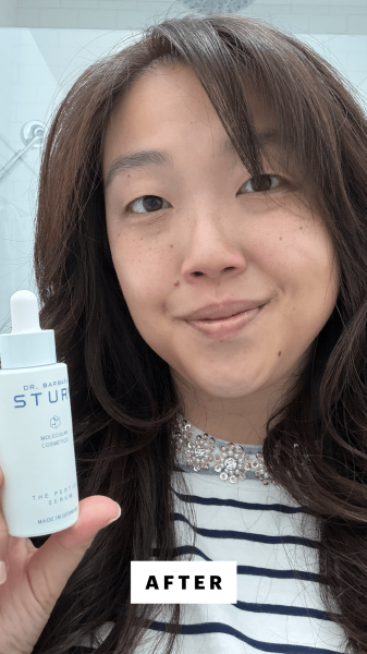 Lee after applying the Dr. Barbara Sturms The Peptide Serum